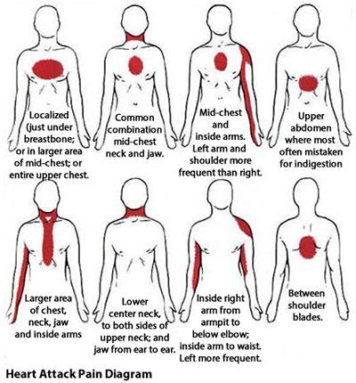 The Top 10 Most Common WARNING Signs 30 Days Before A Heart Attack ...