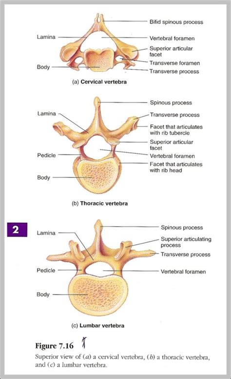 Vertebrae Identification Chart