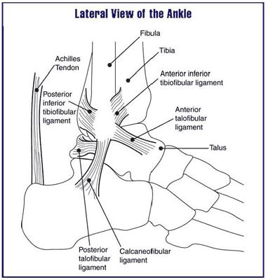 Sprained ankle - wikidoc