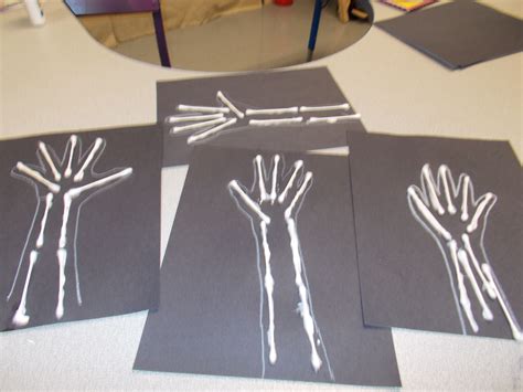 X-ray with q-tips, community helpers, play doctor- Preschool ::Crafts By Mahaley | Kindergarten ...