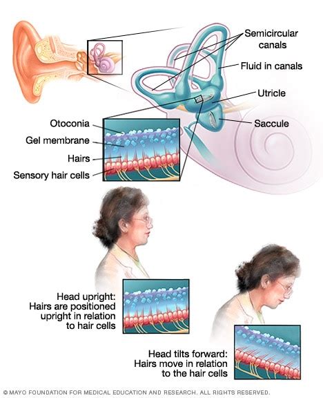 Inner ear and balance - Mayo Clinic