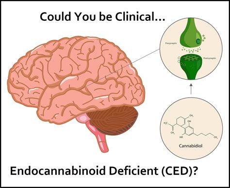 Could You be Clinical Endocannabinoid Deficient (CED)?