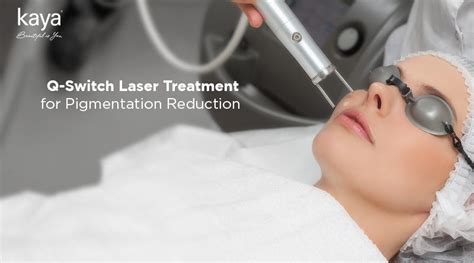 Benefits of Q-Switch Laser Treatment for Pigmentation for Pigmentation ...