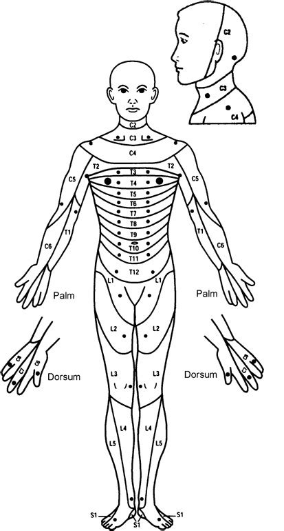 ASIA sensory key points by spinal dermatomes. Reproduced (with ...