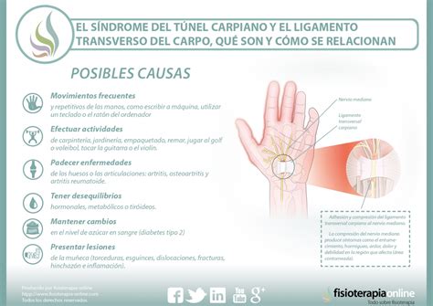 Sindrome del túnel carpiano. Ejercicios y tratamiento | FisioOnline