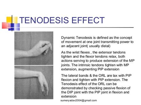 Extensor 1