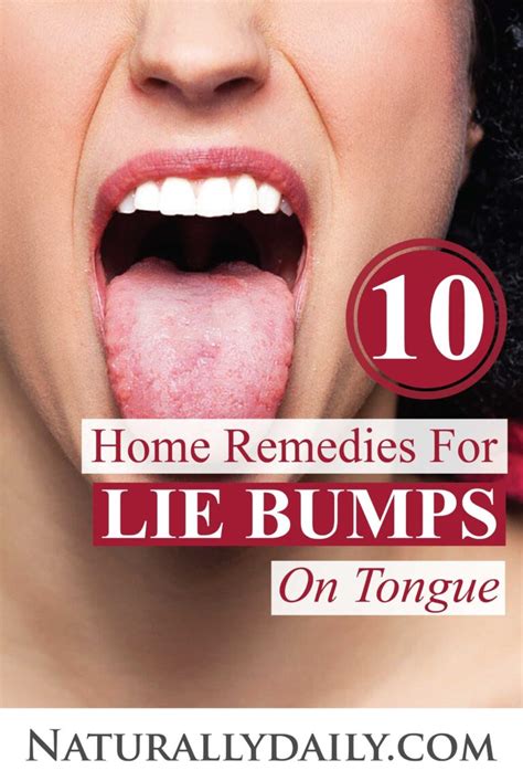 10 Proven Ways to Get Rid of Lie Bumps at Home