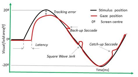 Smooth pursuit test. | Download Scientific Diagram