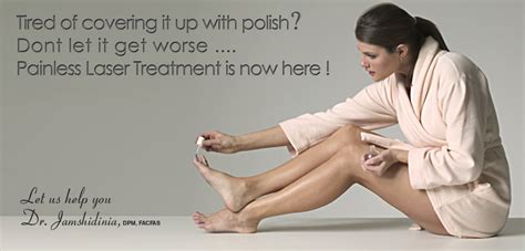 Laser Toenail Fungus Treatment Los Angeles Toenail Fungus Removal