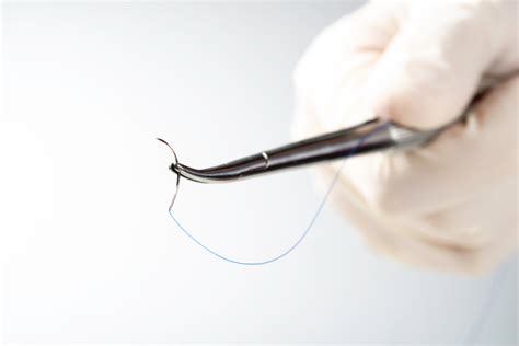 Suture Failure Lawyers | The Gori Law Firm