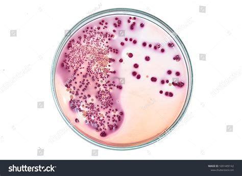 Closeup Gramnegative Bacteria Growth On Macconkey Stock Photo 1691409142 | Shutterstock