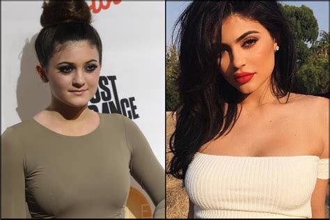 Kylie Jenner on Never Having Surgery on Her Face (Photos ...