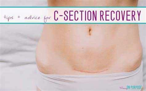 How to Recover from a C-section (as quickly as possible) - Mommy on Purpose