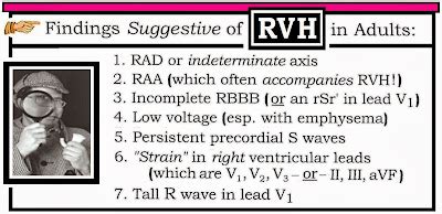 ECG Interpretation: ECG Interpretation Review #77 (Chamber Enlargement ...