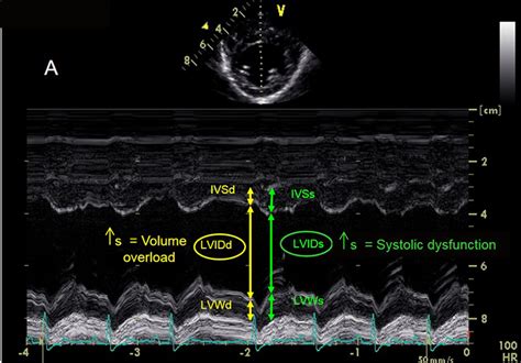 Echocardiography in General Practice: 4 Views to Master | Clinician's Brief