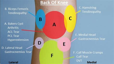 Knee Pain Common Causes Of Knee Pain – NBKomputer