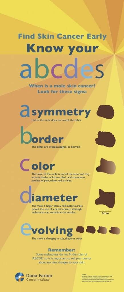 What is an Atypical Mole? | Dana-Farber Cancer Institute