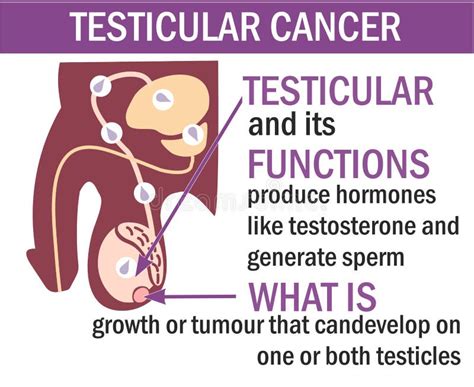 Testicular cancer stock vector. Illustration of cells - 32882204