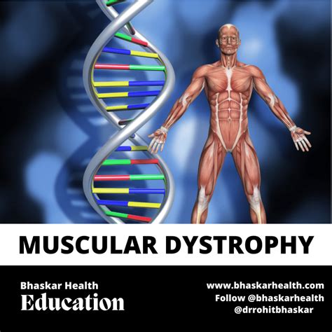 (PDF) Muscular Dystrophy: Physiotherapy Treatment