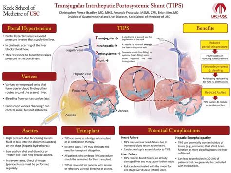 Transjugular Intrahepatic Portosystemic Shunt (TIPS) - American Liver ...