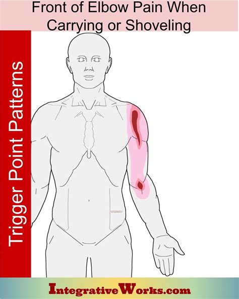 Front of Elbow Pain When Carrying or Shoveling - Integrative Works | Elbow pain, Shoulder pain ...