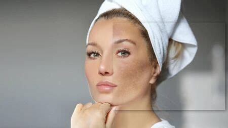 The Skin Nerd: What you need to know about age spots, patchiness, or pigmentation