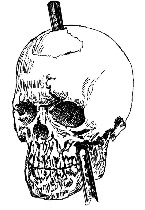 Thru My Eyes: The Unbelievable Story of Phineus Gage