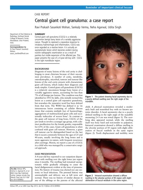 (PDF) Central giant cell granuloma: A case report