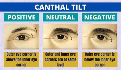 canthal tilt in 2024 | Face reading, Ancient knowledge, Ocular