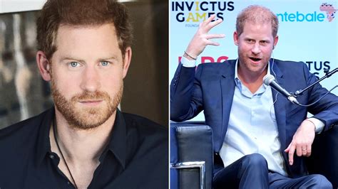 Prince Harry criticized over new photo showing fuller head of hair after mocking Prince William ...