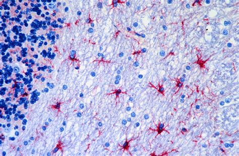 Astrocyte brain cells, light micrograph - Stock Image - P360/0533 - Science Photo Library