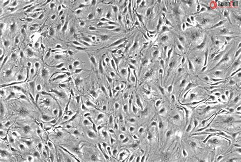 Human Choroid Plexus Endothelial Cells, HCPEC