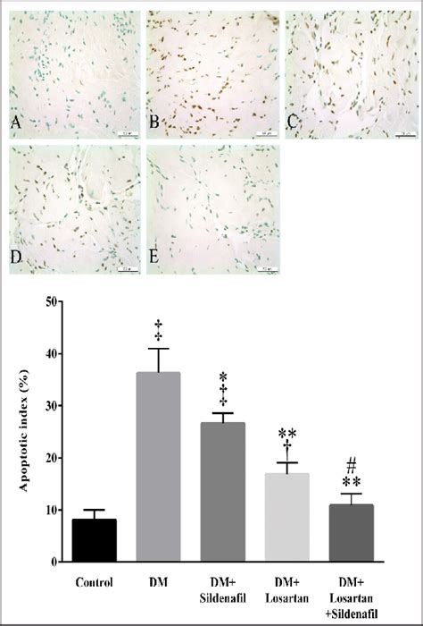 Detection of apoptosis. Representative micrographs show apoptotic cells... | Download Scientific ...