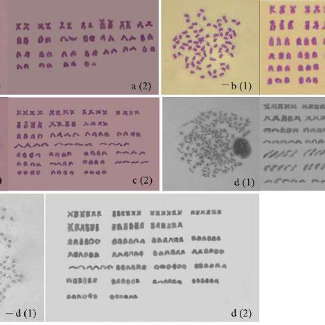 The representative metaphase chromosome (1) and the corresponding... | Download Scientific Diagram