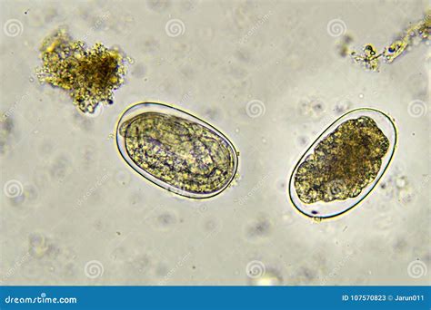 Hookworm In Stool Royalty-Free Stock Image | CartoonDealer.com #106455526