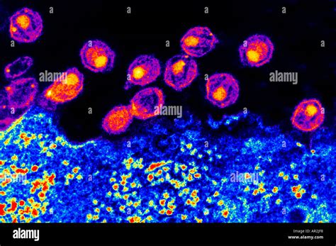 TEM Transmission Electron Microscope of AIDS virus Stock Photo - Alamy