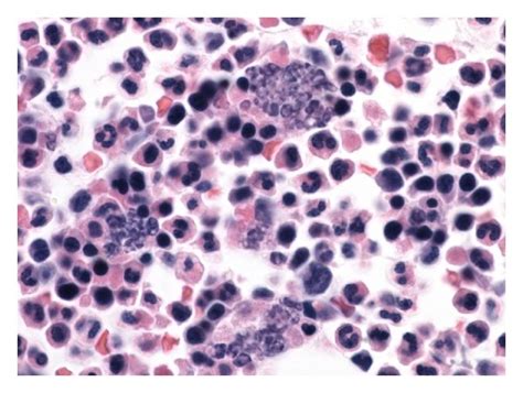 Macrophage Histology