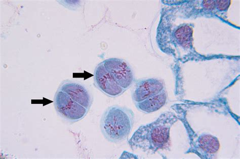 Meiosis in lily anther | scienceforyou