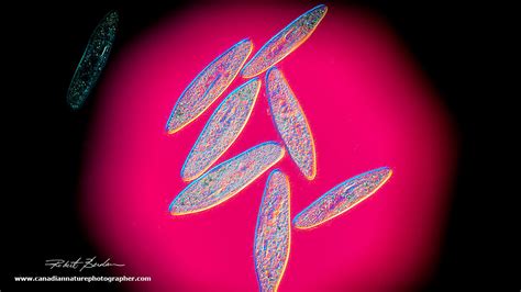 Photomicrography and Video of Protozoa and Rotifers by Robert Berdan - The Canadian Nature ...