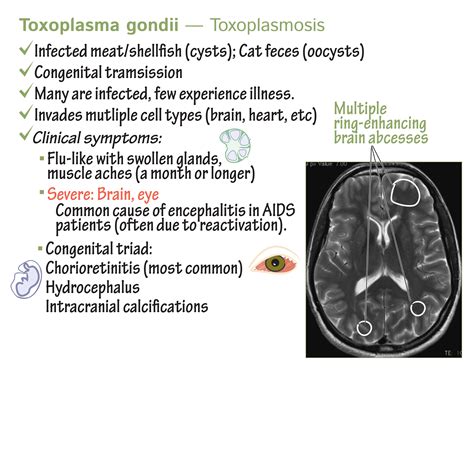 Immunology/Microbiology Glossary: Protozoa - Toxoplasma gondii ...