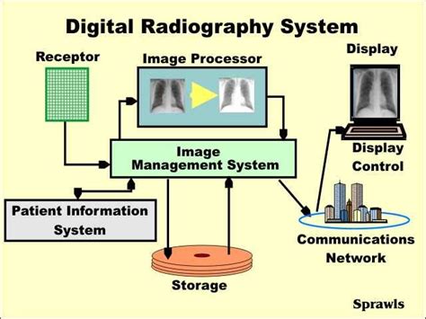 Digital Radiography | Digital radiography, Radiography, Communication networks