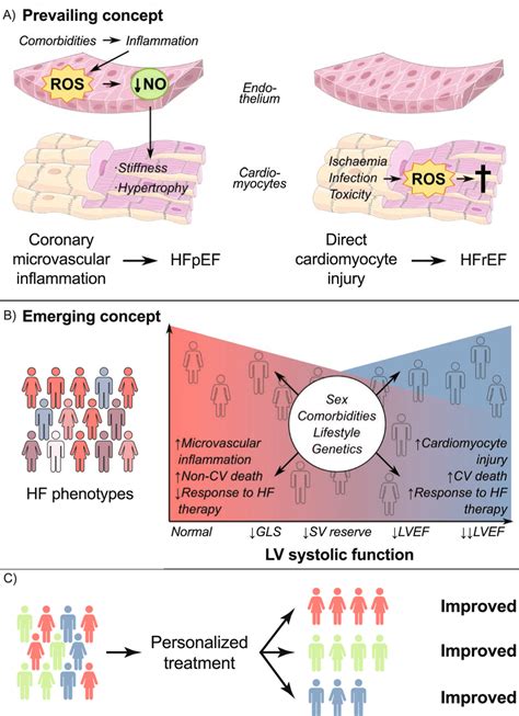 Evolution of pathophysiological understanding of HFpEF [84]. A ...