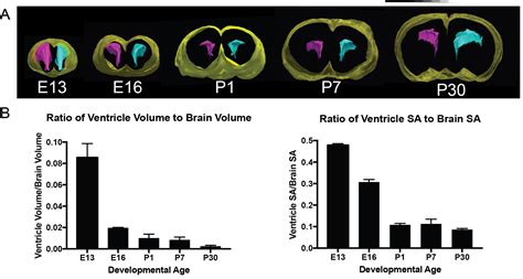 Brain Development in Hydrocephalus | Conover Laboratory