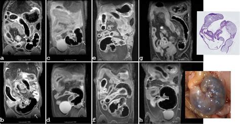 Examples of the development of the Peyer´s patches are given for a ...