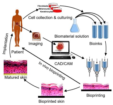 1: The 3D bioprinting process of skin tissue [81]. | Download ...