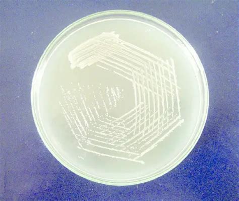 What is Nutrient Agar - Composition, How to Prepare and Uses - Laboratoryinfo.com