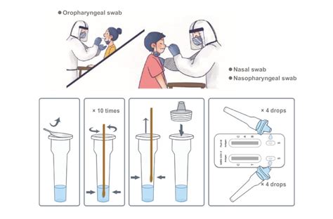 SARS-CoV-2 & Influenza Antigen Rapid Test Kit (A254397)