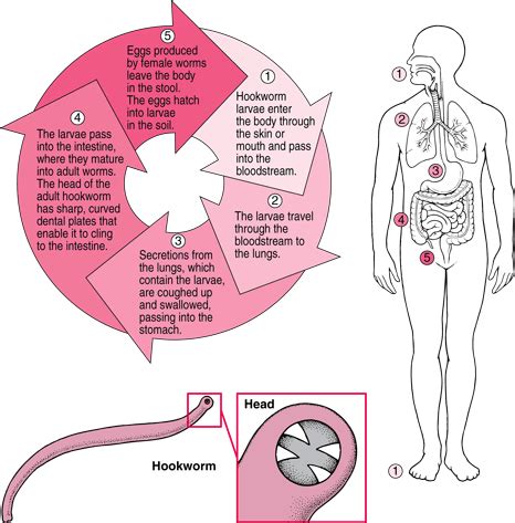 Environmental Health 320 2012F: HookWorms