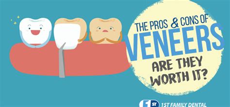 The Pros and Cons of Veneers. Are They Worth It? - 1st Family Dental Blog