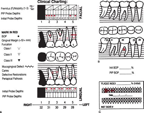 Periodontal measurements: indicators of disease and conditions | Pocket ...